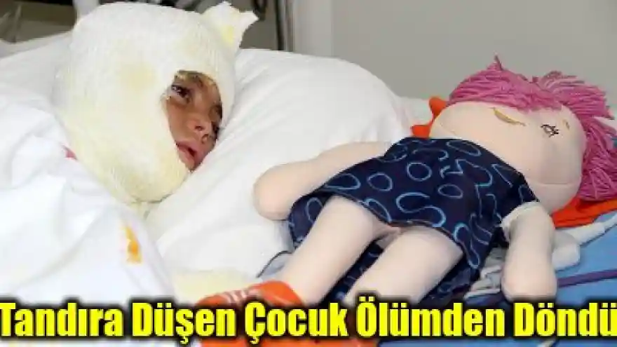 Tandıra Düşen Çocuk Ölümden Döndü
