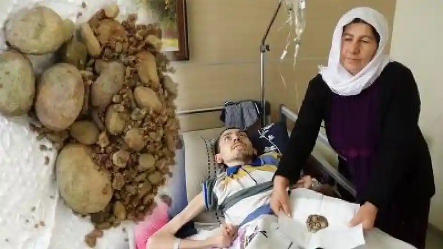 Avuç Dolusu Taş Çıkarıldı